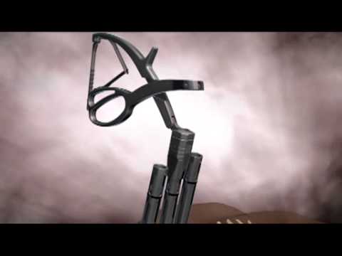 Expedium Viper 2 Rod Approximator Video