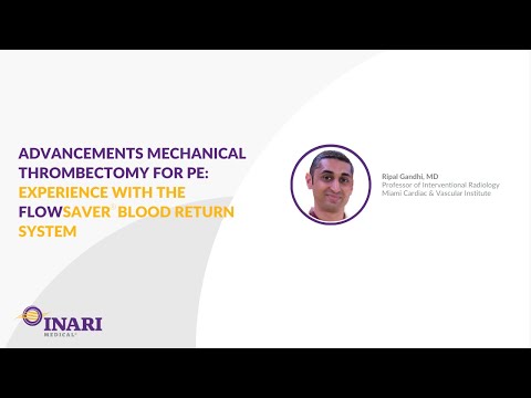 Advancements Mechanical Thrombectomy for PE Experience ...
