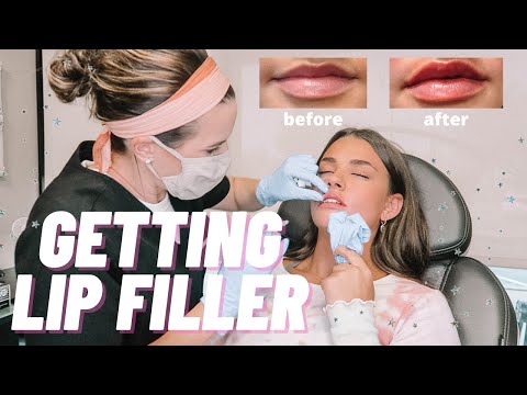 getting lip injections for the first time!! *full experience*