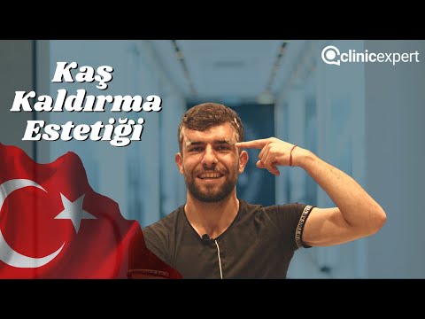 Real Patient Experience – Affordable Eyebrow Lift Surgery in Turkey