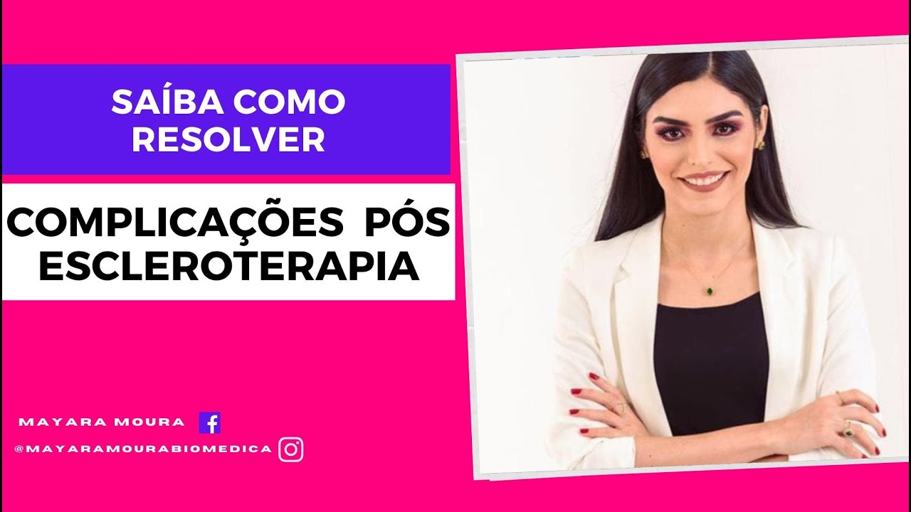 Escleroterapia - Quais as principais complicações?