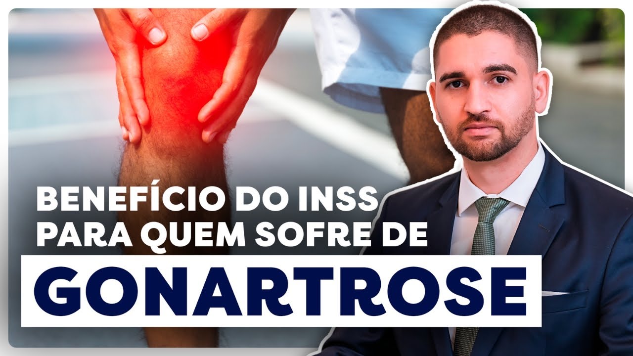Gonartrose - Artrose nos joelhos CID M 17 e INSS: Auxílio-doença, aposentadoria ou auxílio-acidente?