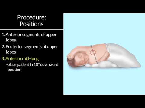 Watch lagu Images Videos Cerebral Palsy Respiratory, Watch Images Cerebral Palsy Respiratory free Watch Images, Watch Images Cerebral Palsy Respiratory