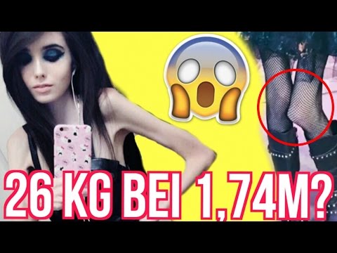 MAGERSUCHT - Youtuberin HUNGERT sich zu TODE 😱😢 Video