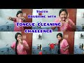 Tongue Cleaning Requested Video