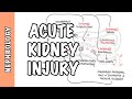 Acute Kidney Injury AKI Prerenal Intrarenal And Postrenal Causes And Pathophysiology