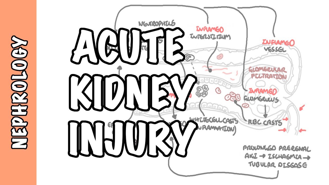 Acute Kidney Injury (AKI) - prerenal, intrarenal and postrenal causes and pathophysiology