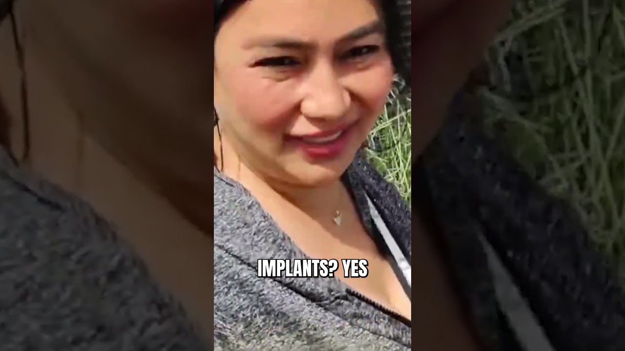 California Values Free Implants Over Citizens