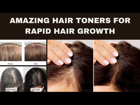Amazing Hair Toners for Rapid Hair Growth | Beauty...