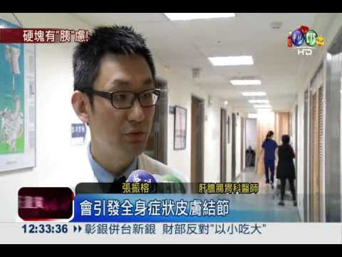 小腿硬塊潰爛 竟是急性胰臟炎