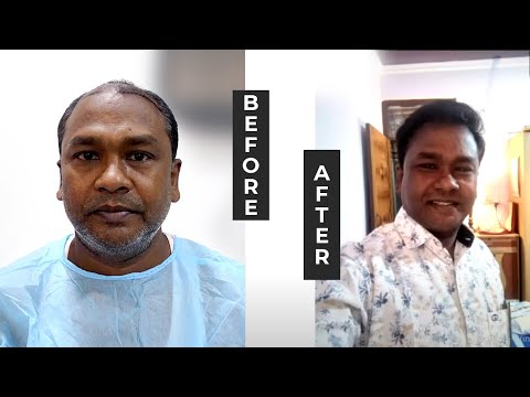 Rahul Sehrawat  Berkowitz