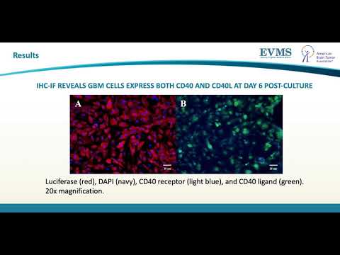 Thumbnail image of video presentation for Neuro-inflammatory targets in glioblastoma multiforme