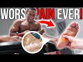 The WORST PAIN! | Fixing 28 YEARS Of Flat Feet w/ NEEDLES