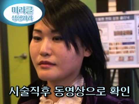 Miracle Lifting Real Effect