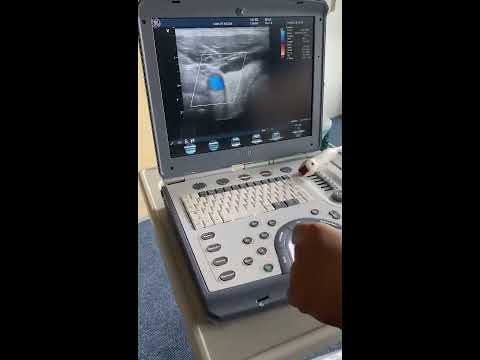 Ultrasound machine General Electric Vivid I with 2 probes : linear and cardiac. CAM