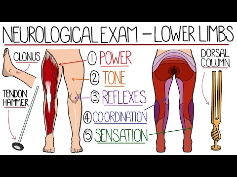 Seizures Seizure Types Generalized vs Focal Seizures Causes of Seizures Mnemonic