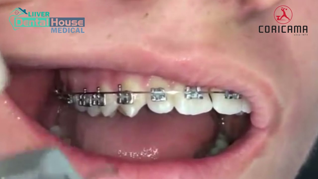 Alicate de Corte Distal Coricama Italia