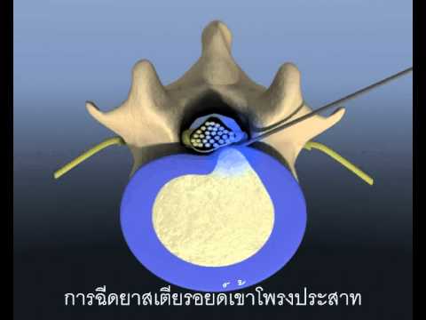 ผลโปรตีนแรงชาย พรูรีวิวชล