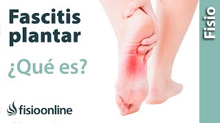 ¿Qué es la fascitis plantar?