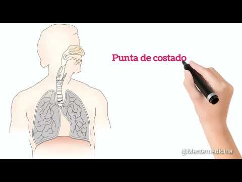 Punta de costado aguda y punta de costado subaguda