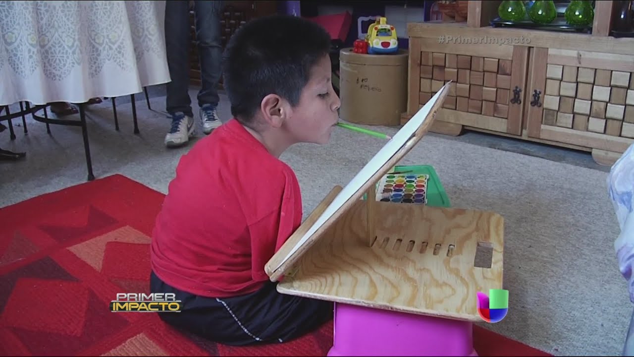 Pese a haber nacido sin extremidades un niño demuestra que todo es posible