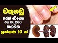 signs-that-your-kidneys-need-help-08-10-2019