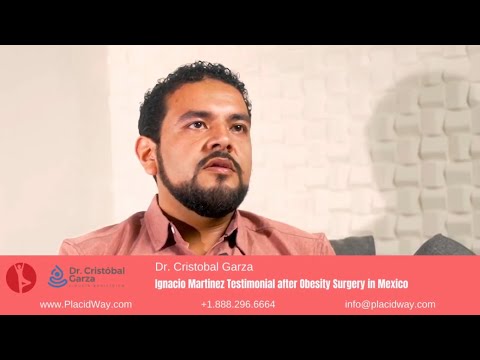 Ignacio Martinez's Remarkable Journey with Gastric Surgery by Dr. Cristobal Garza in Mexico