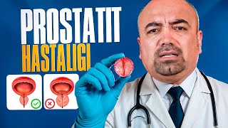 PROSTATIT HASTALIGI 1-QISM | ПОРСТАТИТ ҲАСТАЛИГИ 1-ҚИСМ