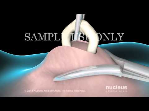 download lagu mp3 mp4 Imagenes De La Causa Limea, download lagu Imagenes De La Causa Limea gratis, unduh video klip Imagenes De La Causa Limea