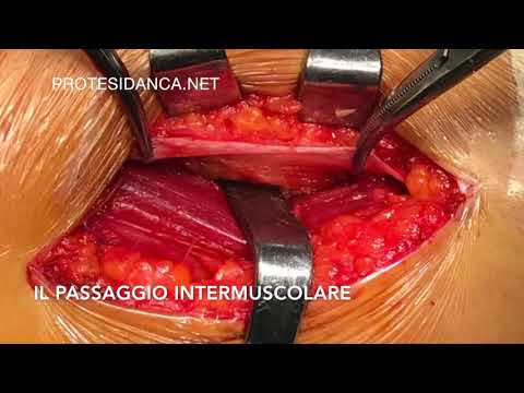 Esercizi per rafforzare i tendini e articolazioni Che circonda un forte dolore allo stomaco e schiena