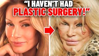 Catwoman Jocelyn Wildenstein: The Truth Behind the Face! Extreme Bodies Explained!