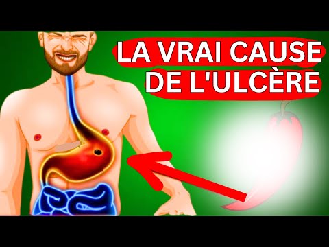 Comment guérir les ulcères d'estomac naturellement: 4 aliments essentiels à inclure dans votre alime