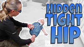 Torticollis Can Cause a Tight Hip? What Now? 👶🏻 | Torticollis Treatment #66