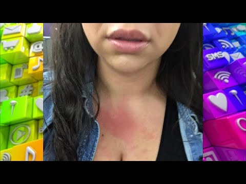 Could Your Skin Rash Be Caused by Stress?