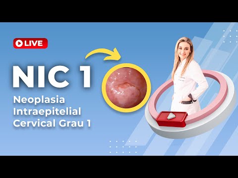 Qual o tratamento de Nic 1?