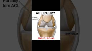 5 Best ACL Recovery Exercises | Phase 1 Rehab