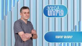 Եղիր առողջ. մաքուր ձեռքեր