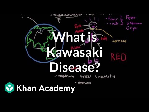 What is Kawasaki disease? | Circulatory System and Disease | NCLEX-RN | Khan Academy