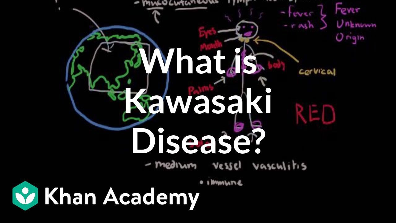 What is Kawasaki disease? | Circulatory System and Disease | NCLEX-RN | Khan Academy