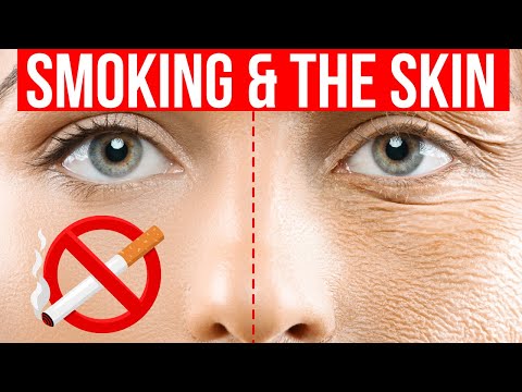8 skin signs of SMOKING