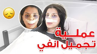 عملت عملية تجميل انفي بتركيا ????????????