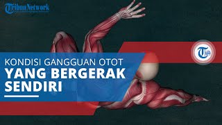 Distonia, Gangguan yang Mengakibatkan Otot Bergerak Sendiri Tanpa Disadari