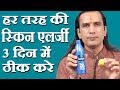 स्किन एलर्जी का घरेलू नुस्खा How To Cure Skin Allerg