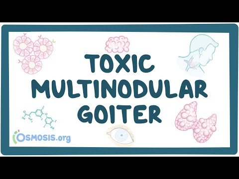 Rheumatic fever heart disease an Osmosis Preview