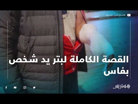 القصة الكاملة لبتر حارس ليلي أصابع أمين مال جمعية سوق الإمام علي بفاس