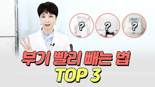 붓기 빨리 빼는 시술 케어! Top3