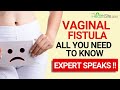 What Is Vaginal Fistula Symptoms Types Treatment Expert Speaks