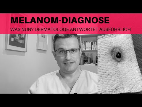 Melanom Diagnose: Was nun?