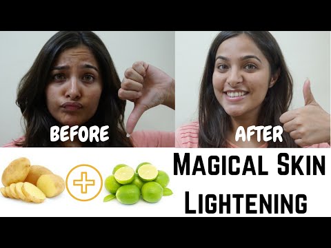 Potato Lemon Face Mask for Glowing and Healthy Skin | DIY Homemade Natural Skin Care