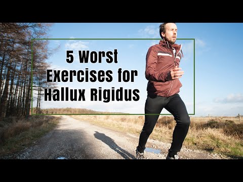 5 Worst Exercises for Hallux Rigidus